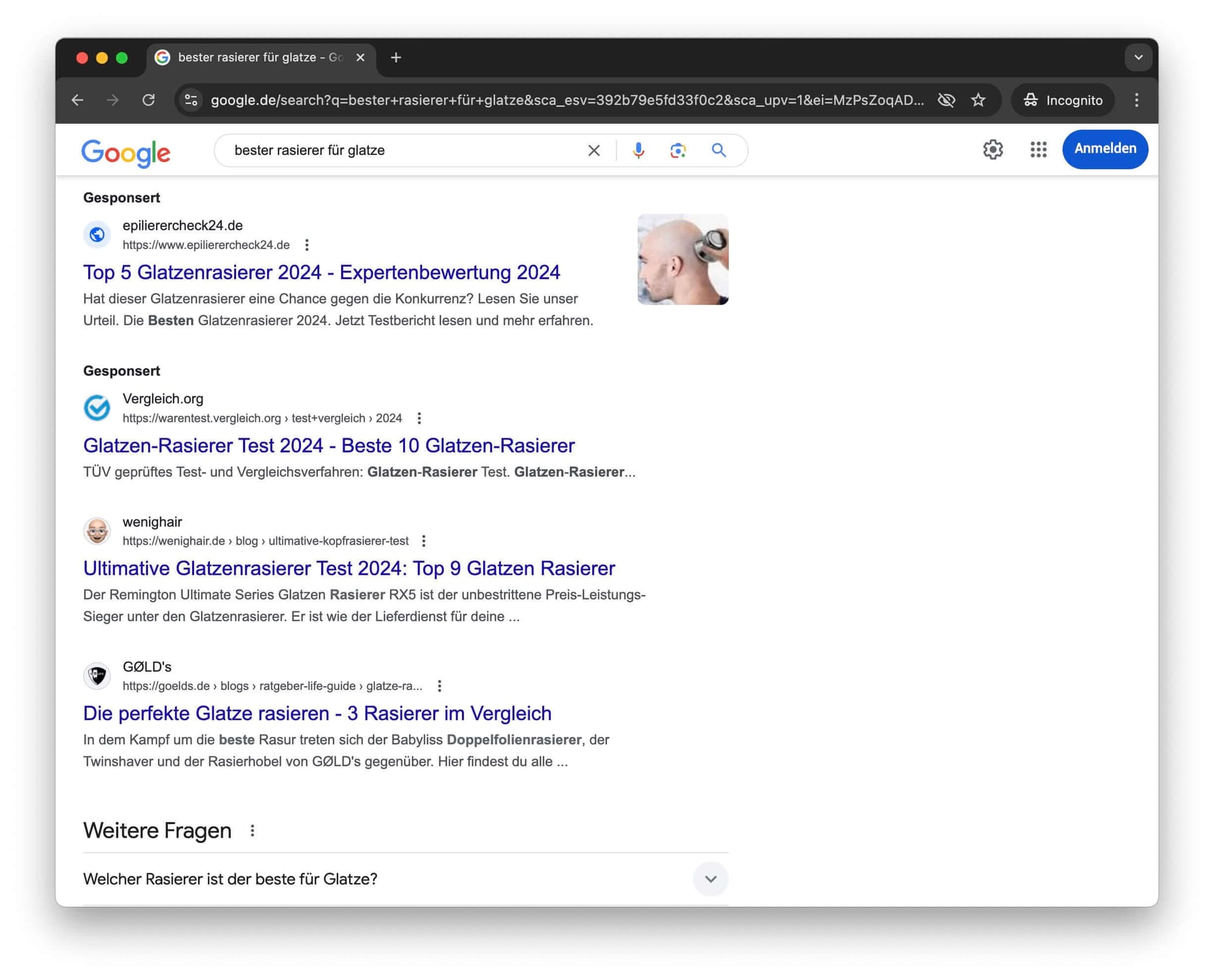 Google-Suchergebnisse für "bester rasierer für glatze" mit wenighair auf Platz 3. Ultimativer Glatzenrasierer Test 2024 von wenighair hervorgehoben.